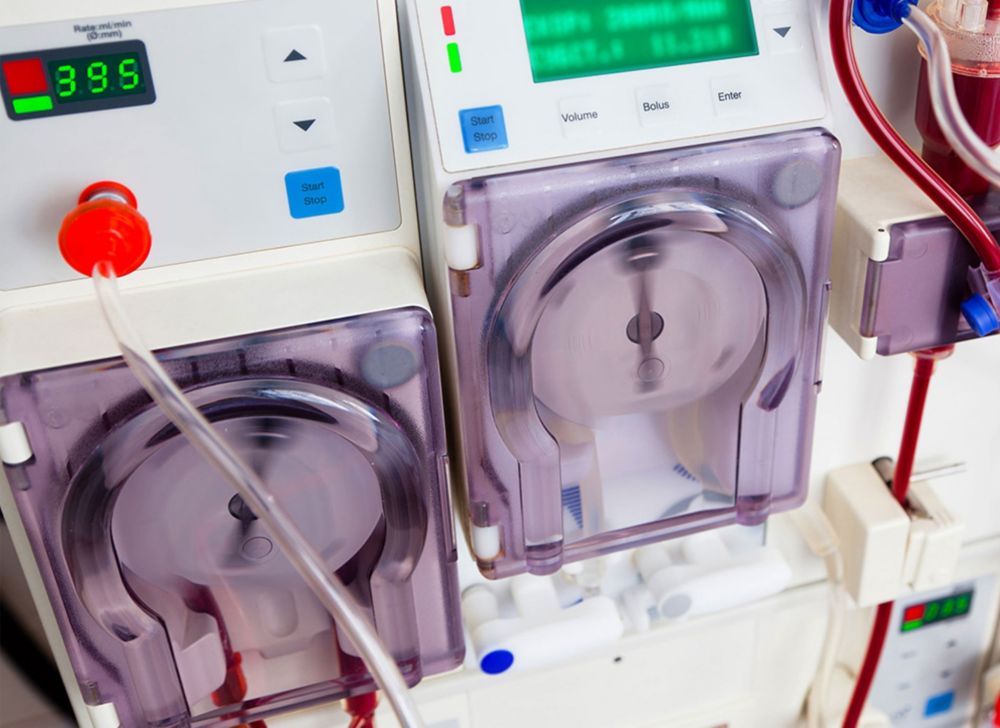 A working kidney dialysis machine. 
