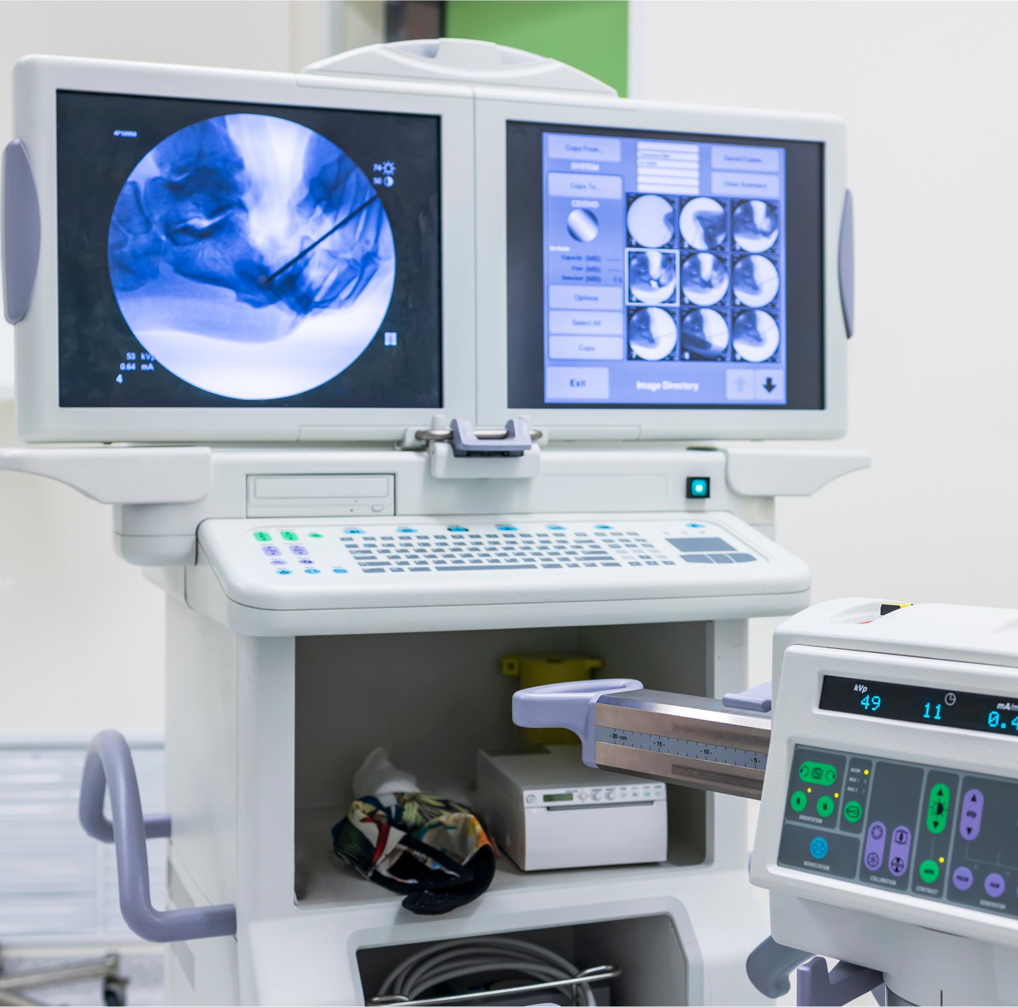 X-ray image on a large monitor.   