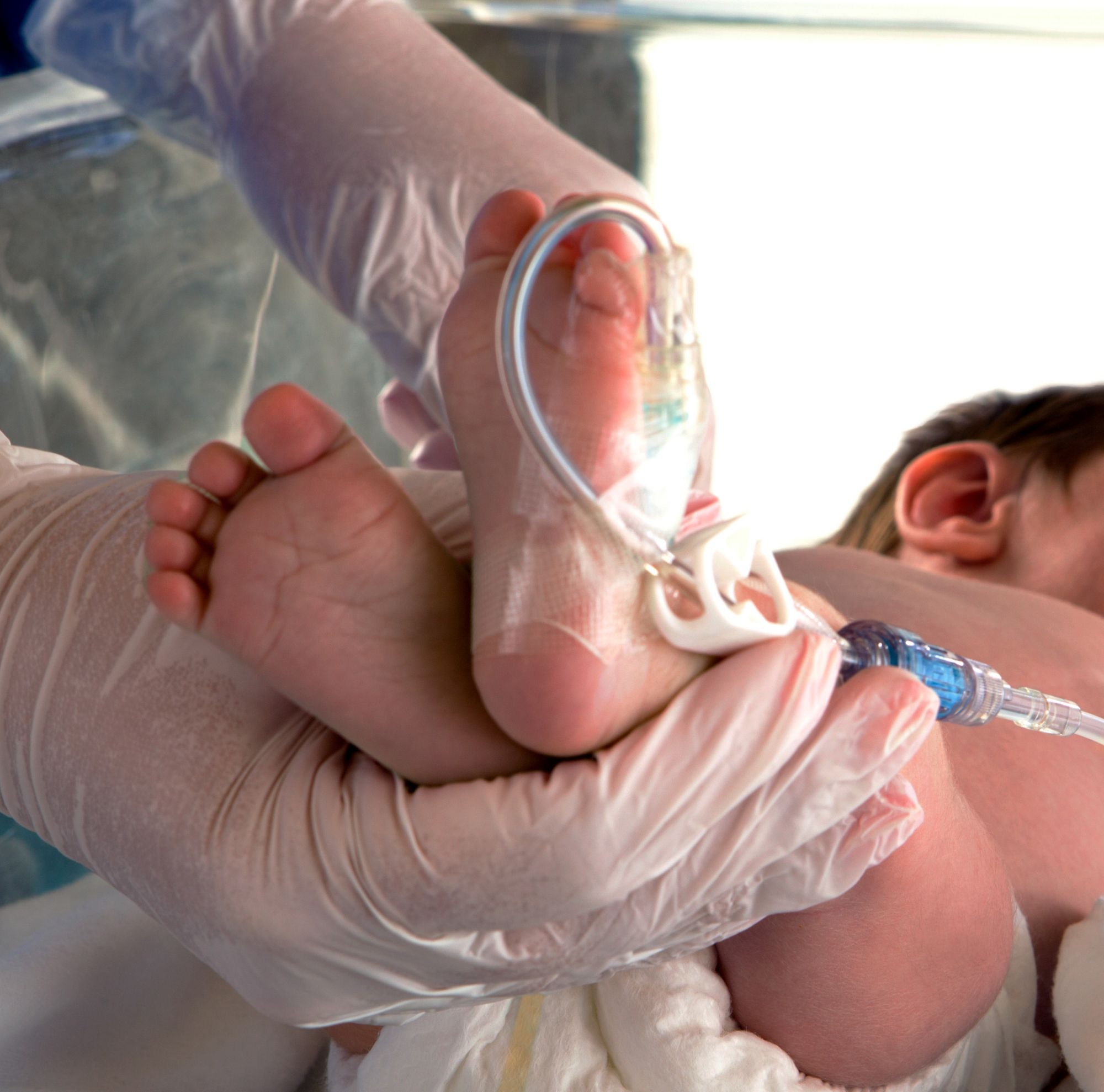 Fluid given to an infant through a clear, medical grade copolyester tube. 