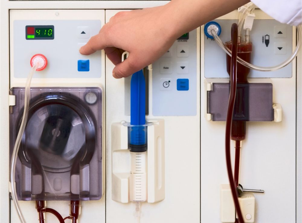 A working dialysis machine.  