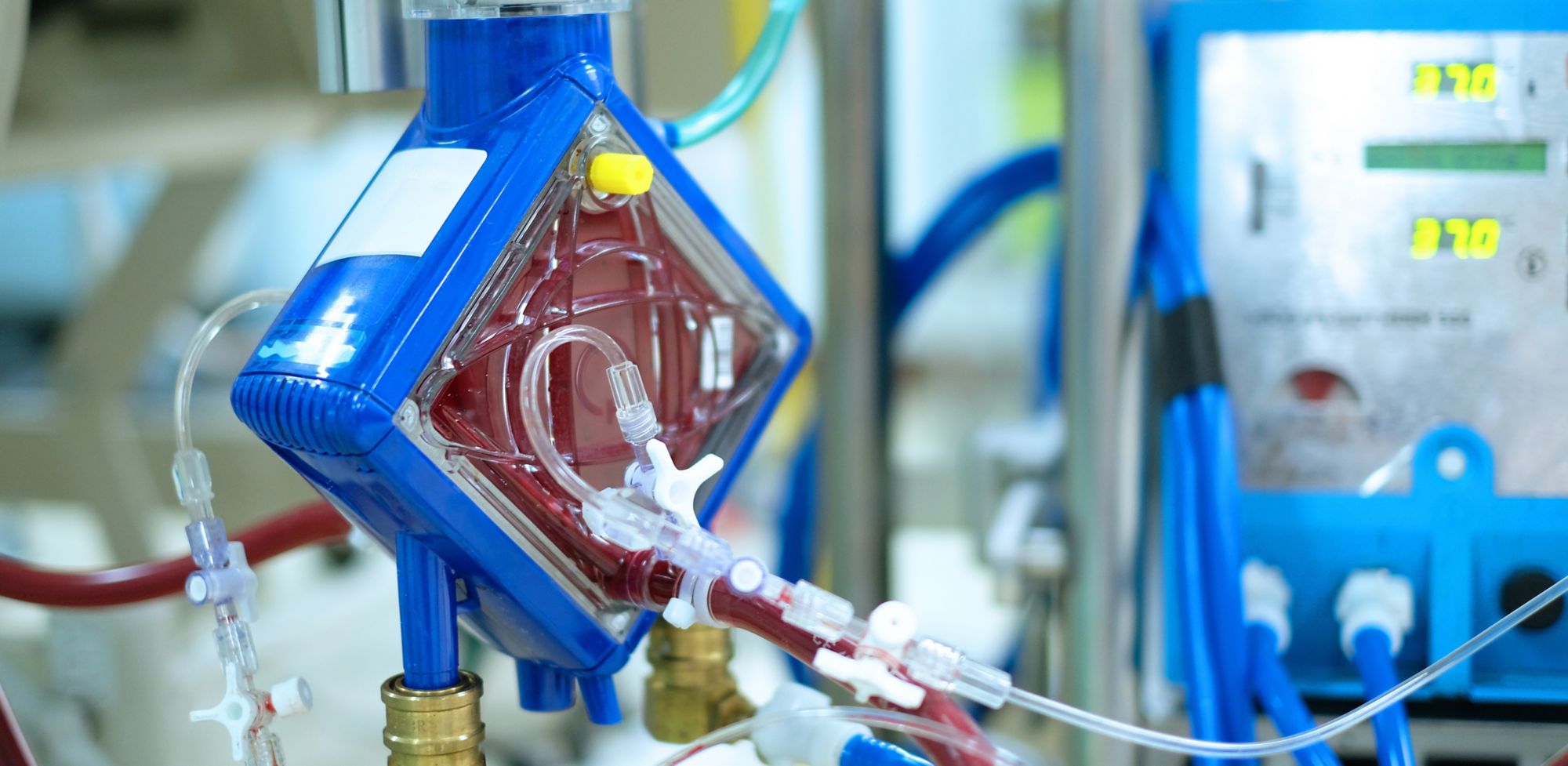 A blood dialysis machine. 